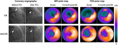 99mTc-sestamibi and 18F-fluorodeoxyglucose imaging in patients with cardiogenic shock: A pilot study